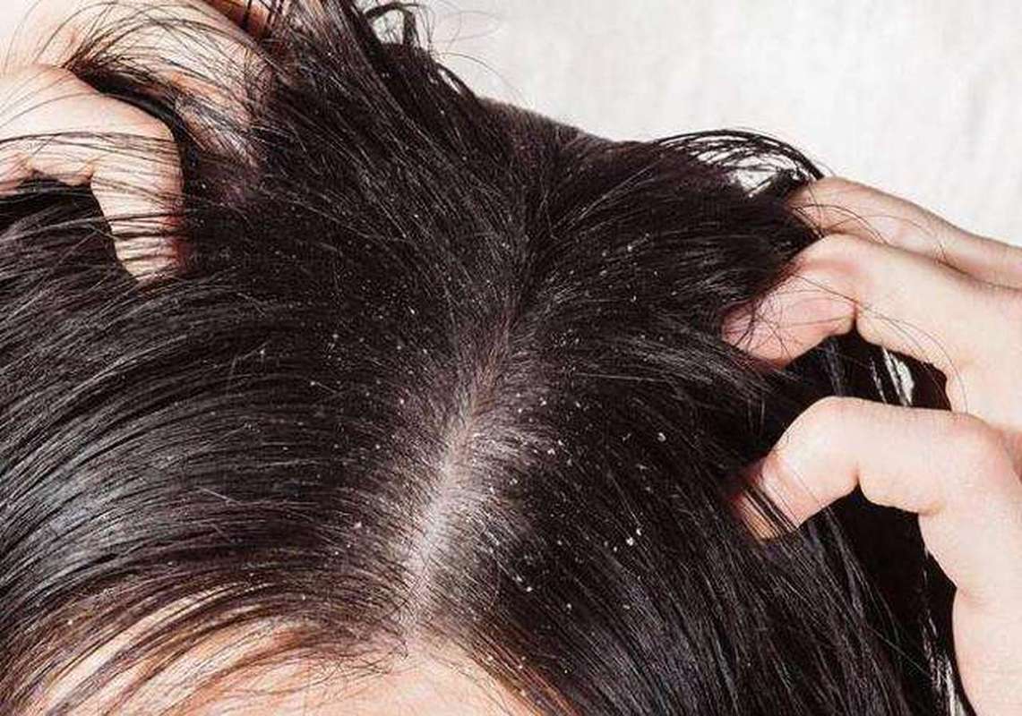 早上洗頭和晚上洗頭，哪個傷害更大？ 頭髮越洗越少？ 早知道早受益