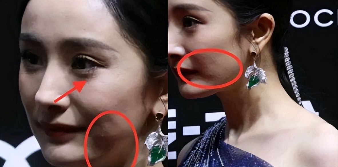 痘痘脸、赘肉、五五分！生图里的女星，让我看见了人间真实