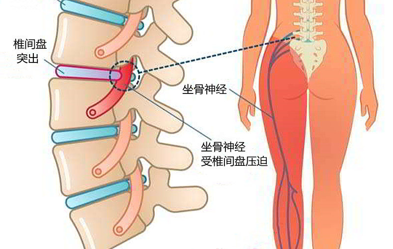 脚看什么科比较好(双脚发麻，像针扎的感觉，什么时候该去看医生？)