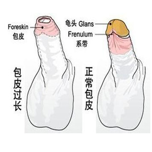 三四十岁的男性，包皮过长，还有必要去做手术吗？一文说清