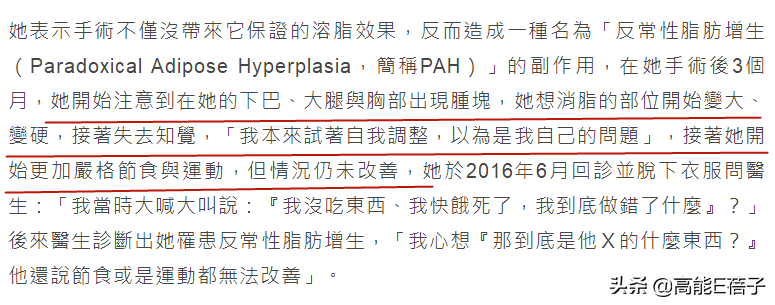 90年代超级模特的鼻祖控诉整形失败，首次公开“永久破坏”照片