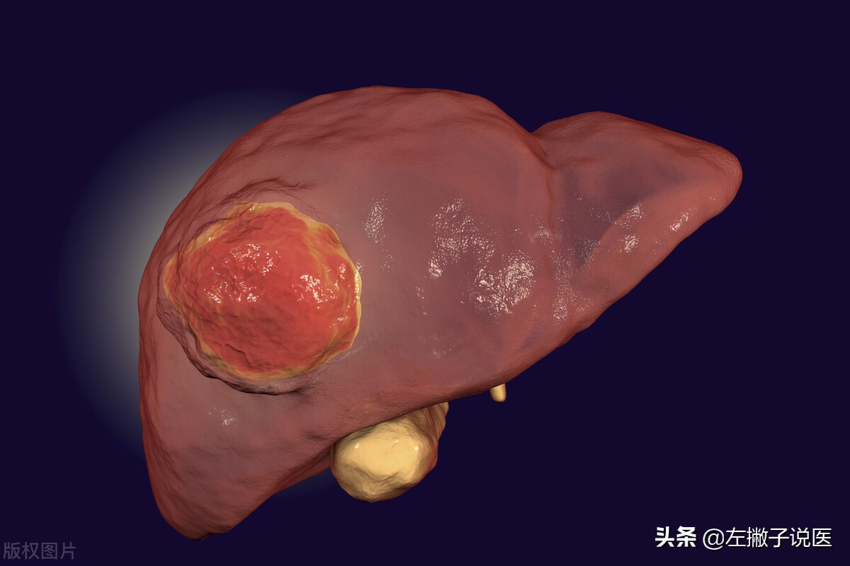 大部分癌症都是“拖”出来的？提醒：5种“小病”最易拖成癌症