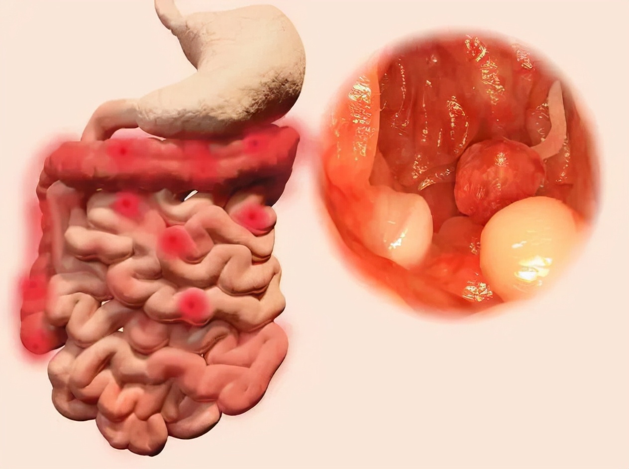 提醒:或跟3种疾病有关