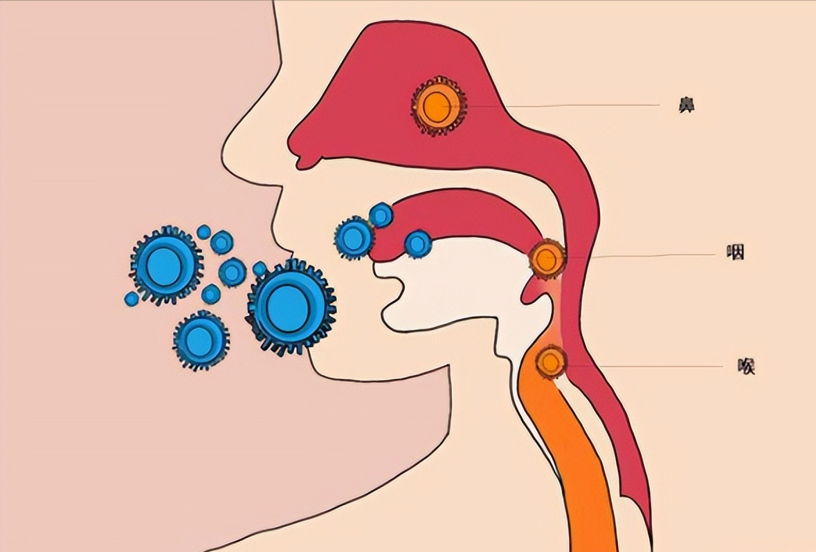 俗话说“黄痰轻，黑痰重，白痰要了命”，是真的吗？揭开痰的秘密