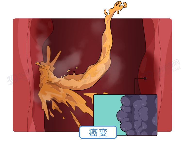 喝水有益健康，但这5个喝水错误，不要也罢！一文告诉你怎么喝