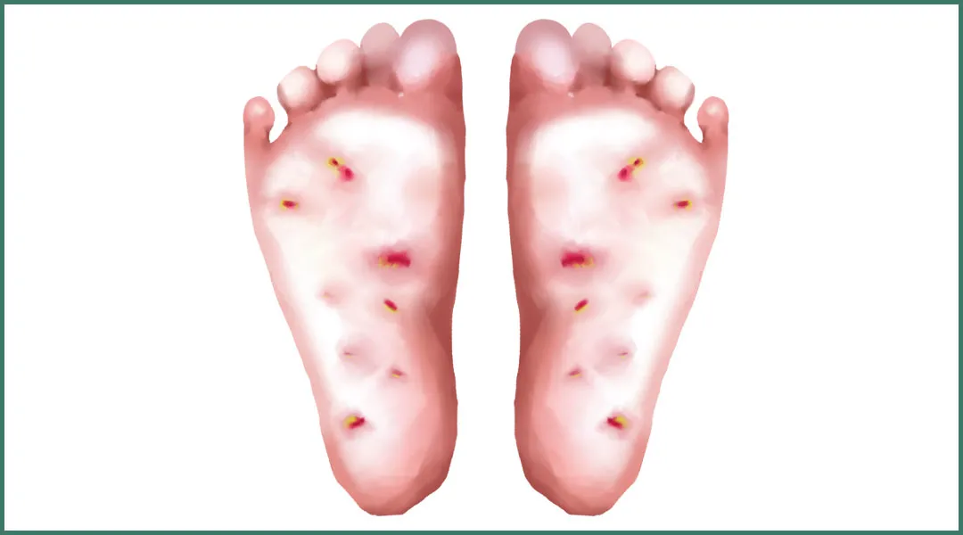 这种令人尴尬窒息的味道，女性比男性还容易有？