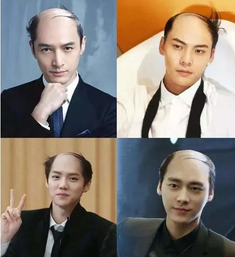 经典搞笑明星图片("看似帅气难挡,实则脱发严重"的10位男星,个个心酸