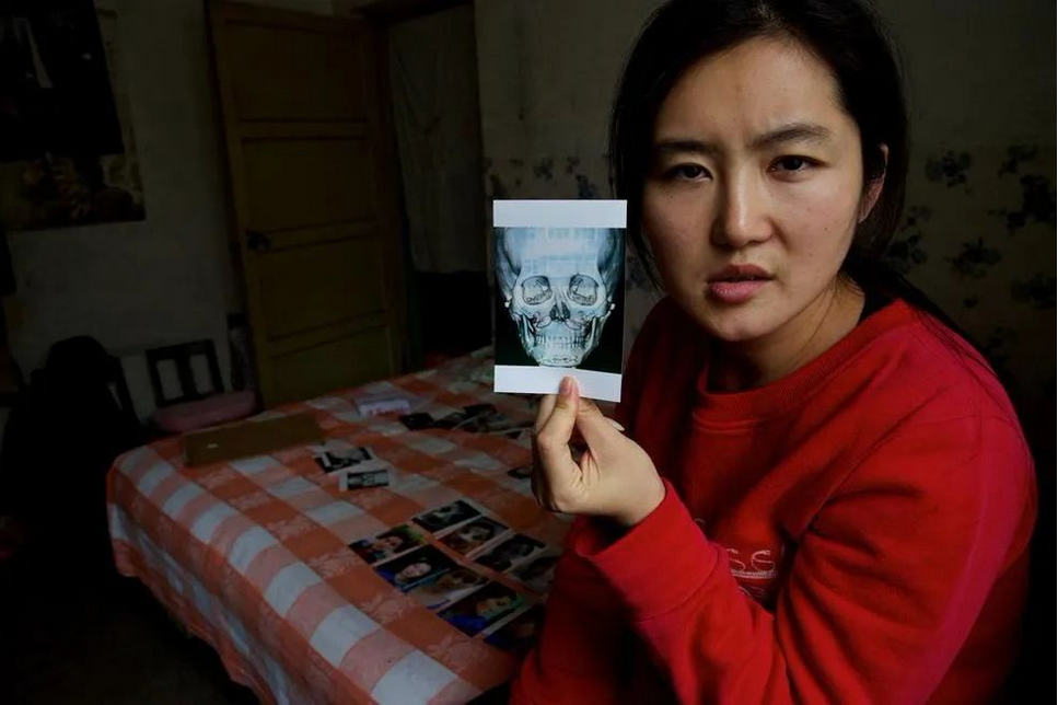 8年前，这个中国姑娘去韩国整容后，她的人生差点被毁掉