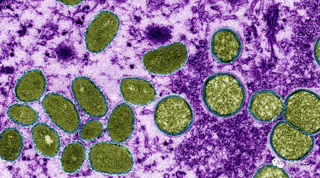 WHO宣布最高级别警告！全球超1.6万猴痘感染者，遍及75国