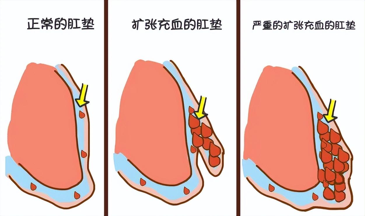 肠道“推粪机”公布，为何没有香蕉？这4种食物平时不妨多吃些