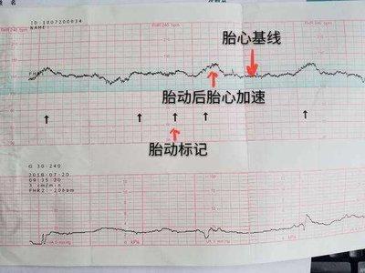 什么是胎心监护，什么时候开始做，如何帮助顺利通过呢？