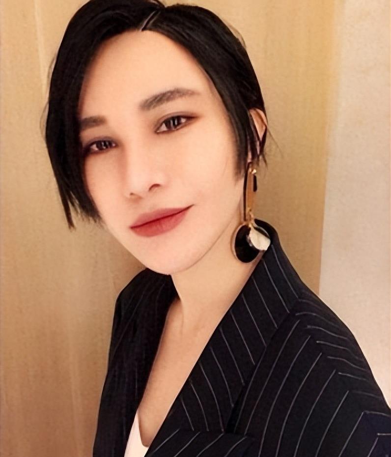 曾是超女冠军,却因整容失败像“怪物”,全身只剩下眼珠是自己的