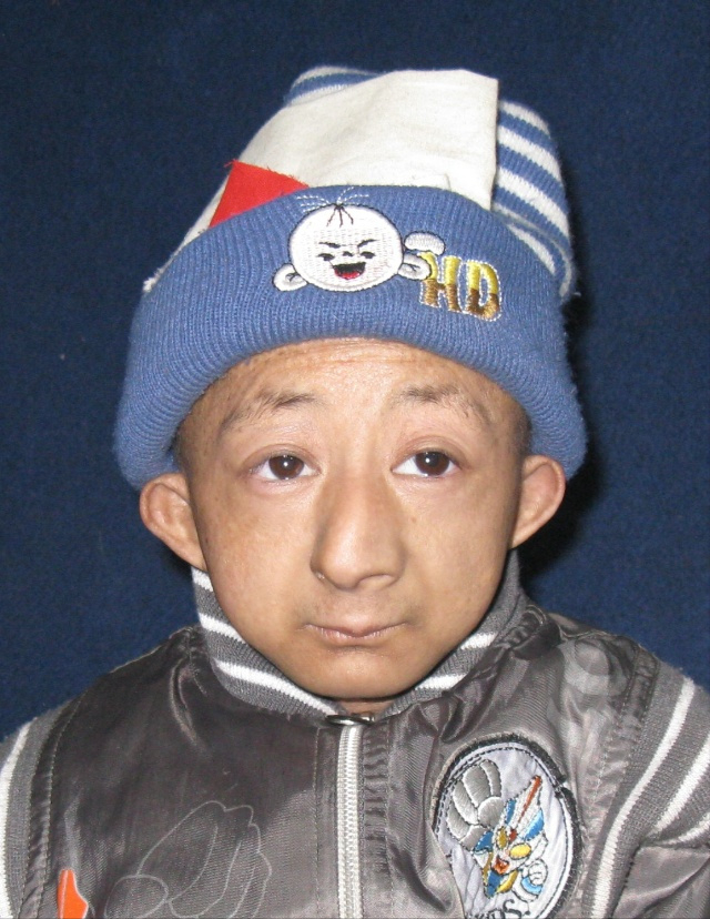 世界上最矮的人 中国最矮的人排名-沈阳老侃