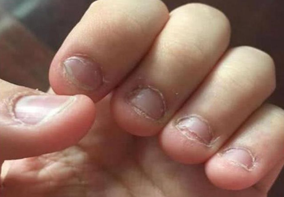 婴儿总咬下嘴唇怎么回事(宝宝) - 乐宝宝贝