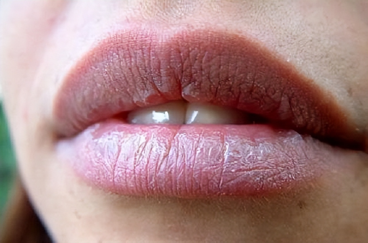 3种唇色反映了你的健康问题)