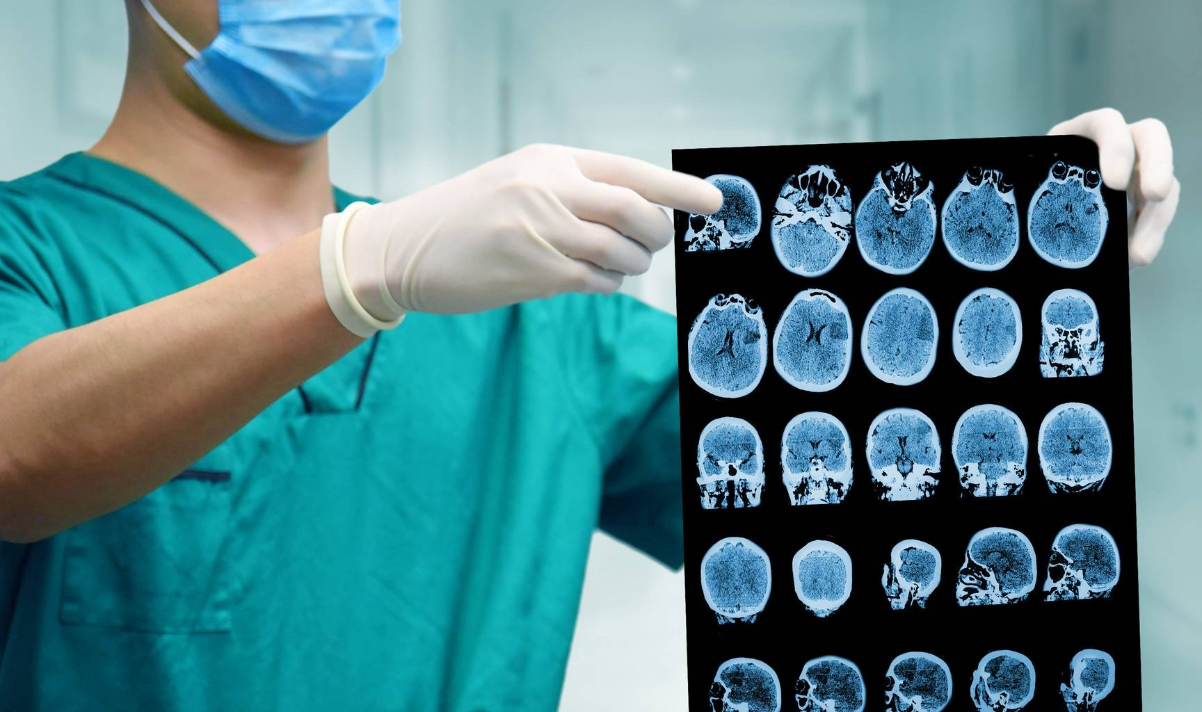 为什么不建议做脑部ct检查?听听专家的见解!早知道早受益