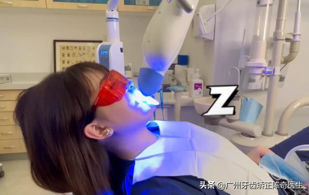 牙黄、牙缝大、牙齿缺损?明星们都在做的牙齿贴面了解一下