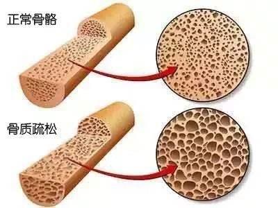 常常吃太咸的东西，会发生什么？提示：身体会出现这几种状况