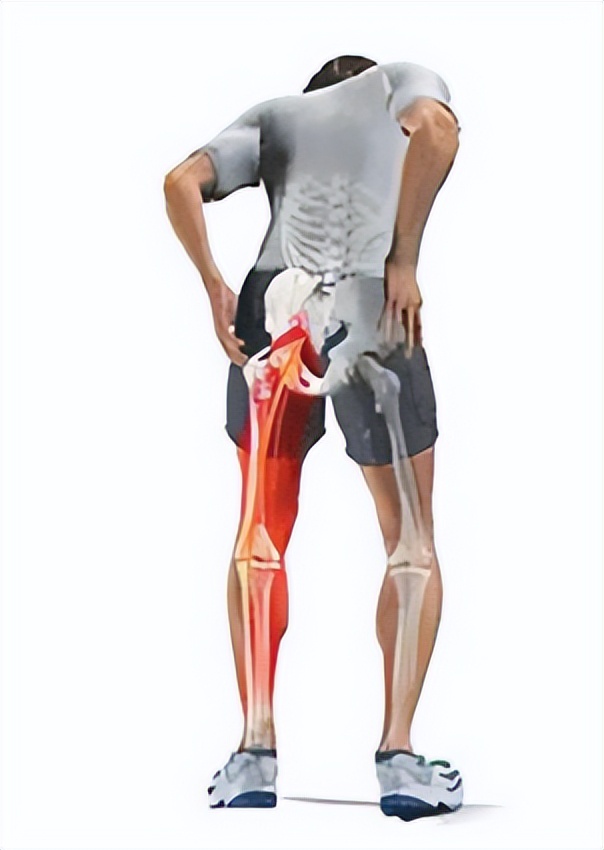 痛,腿痛麻木和脚痛,是根性坐骨神经痛还是干性?看这几类病