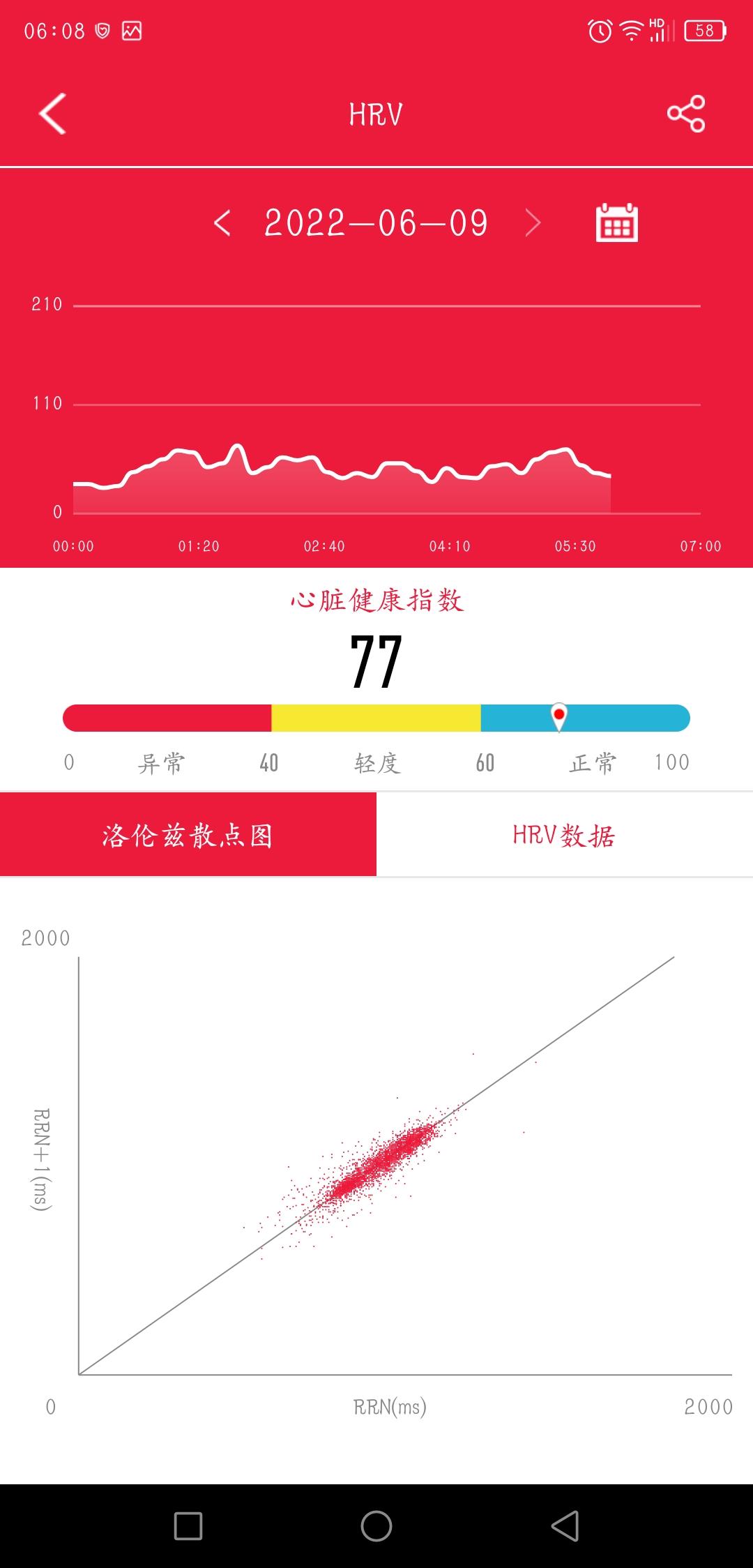 Dido Y1-一款可以智能心电图疾病筛查的智能手环