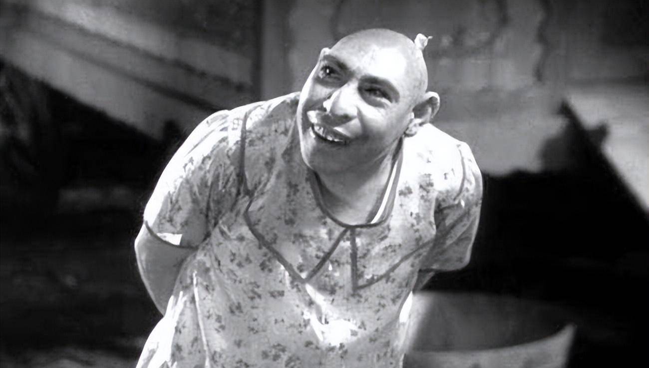 猎奇"畸形秀"的明星,"猴女"与"鳄鱼人"