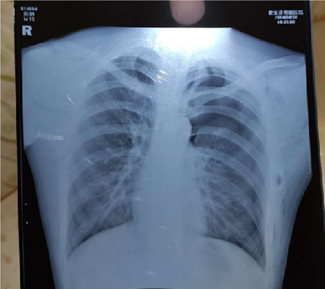 2020年，刺死霸凌者的15岁陈泗翰出狱，出狱前提出：别牵扯班主任