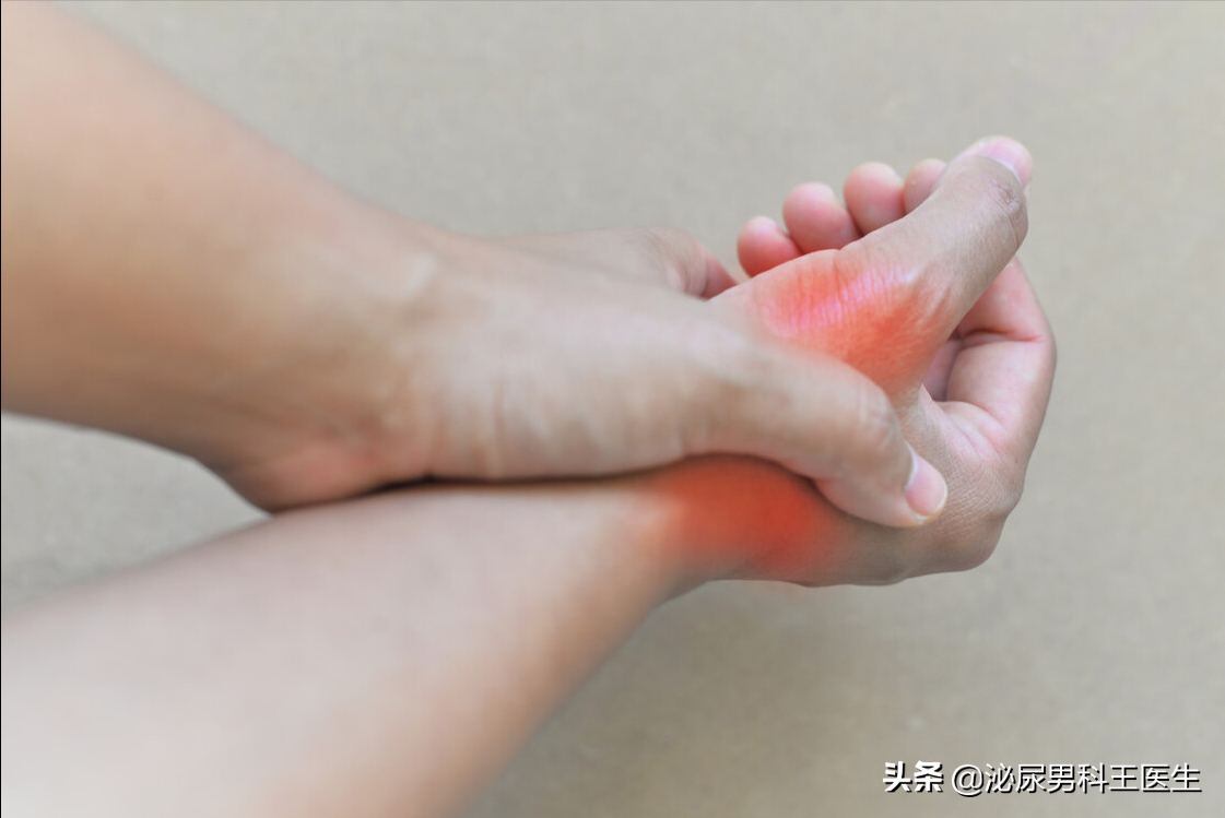 我国痛风高发，“祸根”是豆制品？其实这3种食物才是害人精