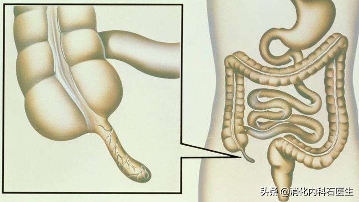 男子腹痛难忍病因难寻，这时肚子上露出一条红线，医生：快会诊