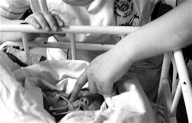 2011年四川产妇诞下中国首例“双头女婴”，后将产检医院告上公堂