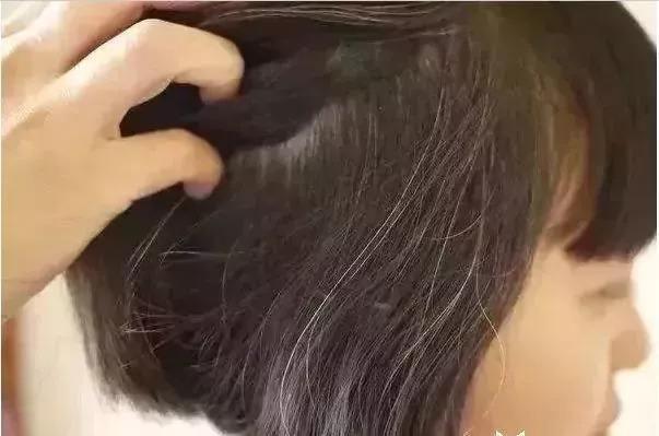前额、两鬓、后脑勺，长白发分别代表着什么意思？
