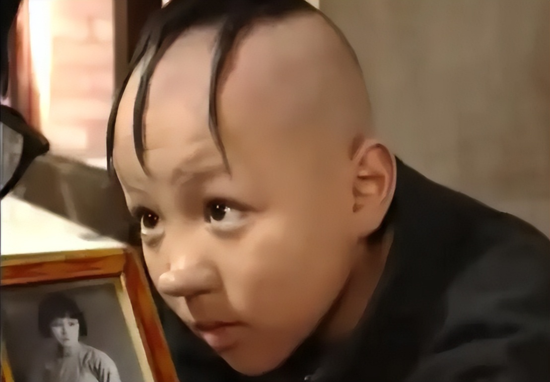 因饰演三毛爆红，14岁秃顶植发挨300多针，童星孟智超怎么消失了