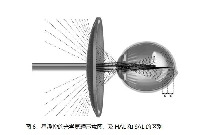 离焦近视眼镜的优缺点-第8张图片-华展网