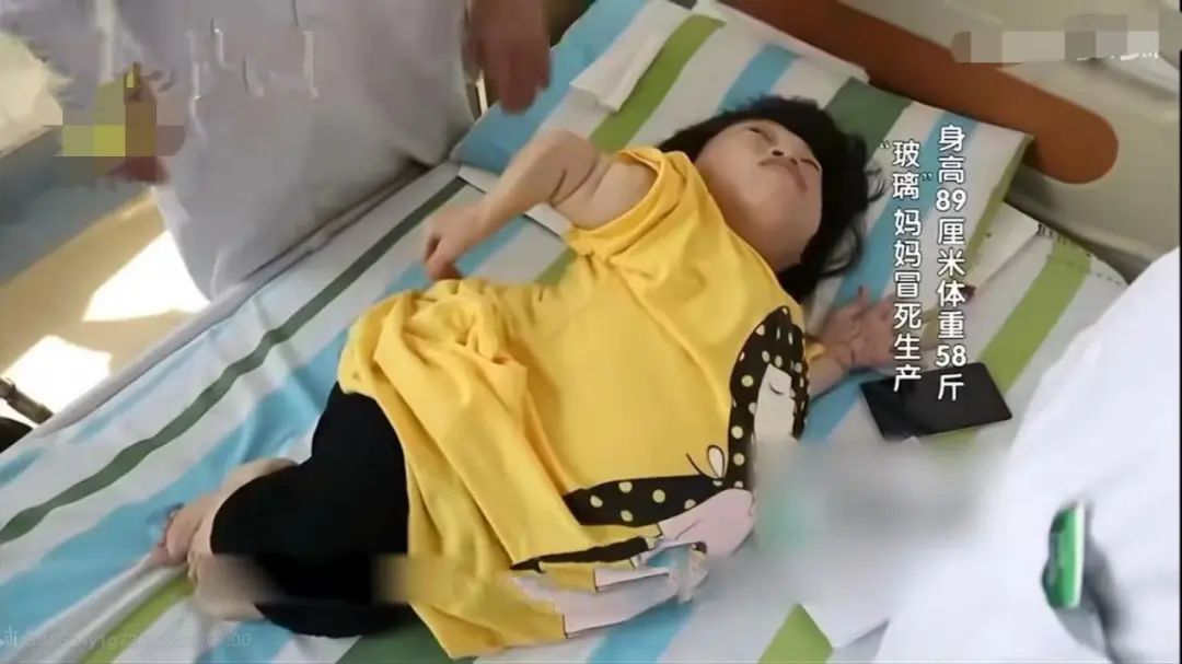 首例“玻璃娃娃”产子：不顾众人劝阻执意生子，如今后悔了吗？