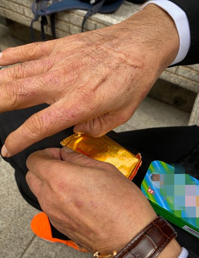 影帝影后多敬业？有人生吞12枚鸡蛋、鼻子被打歪，有人为戏锯门牙