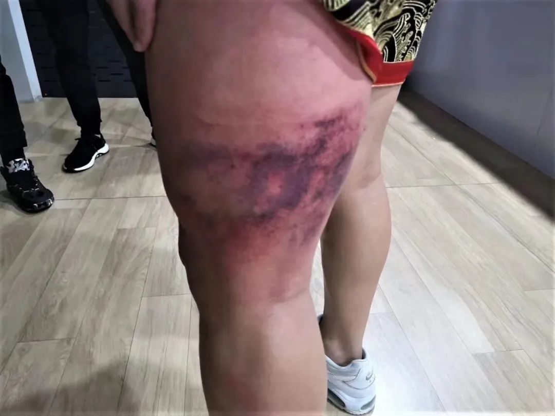 vs2005中文版（经典回顾 - 潇杀狂VS郑召玉，腿部的淤青是胜利的代价）