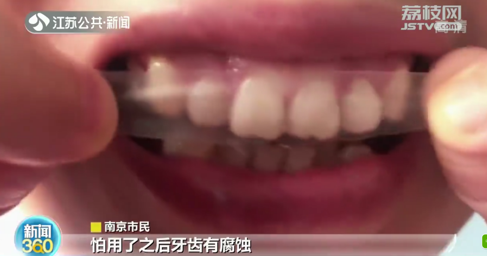 医生：任何所谓美牙神器都不能代替牙刷