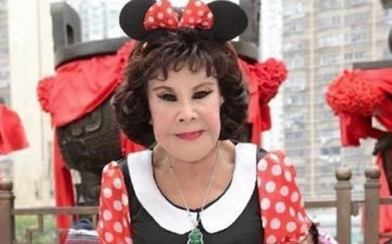 “畸形脸、电风扇脸”，10位整容过度的女星，有人直接命丧手术台