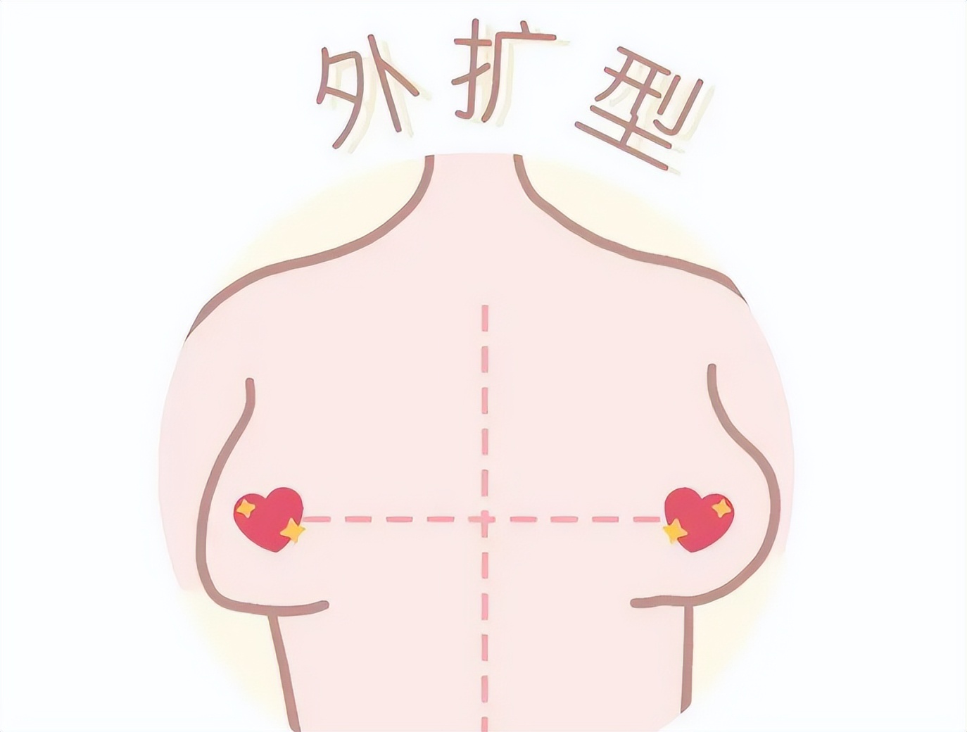 胸小而且外扩怎么办 胸部下垂改善运动方案