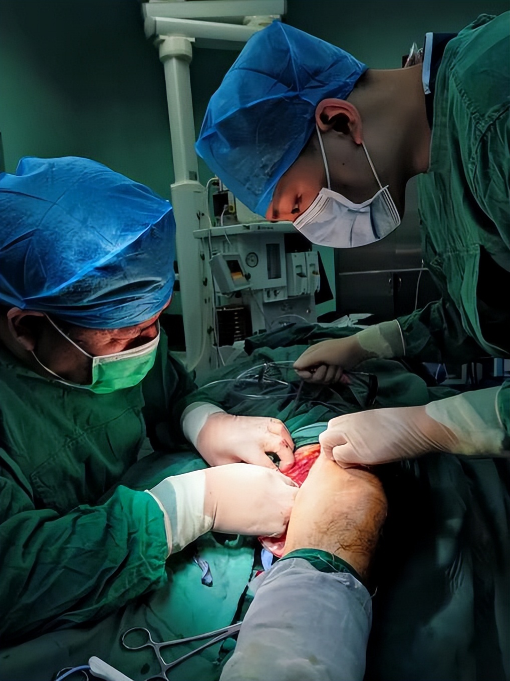 “赶紧！”男子被电锯锯伤腿，郑州市九院的专家这波操作赞了