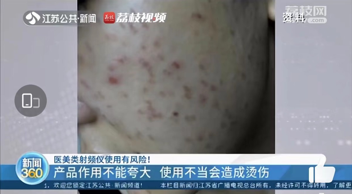 美容仪，你还敢用？