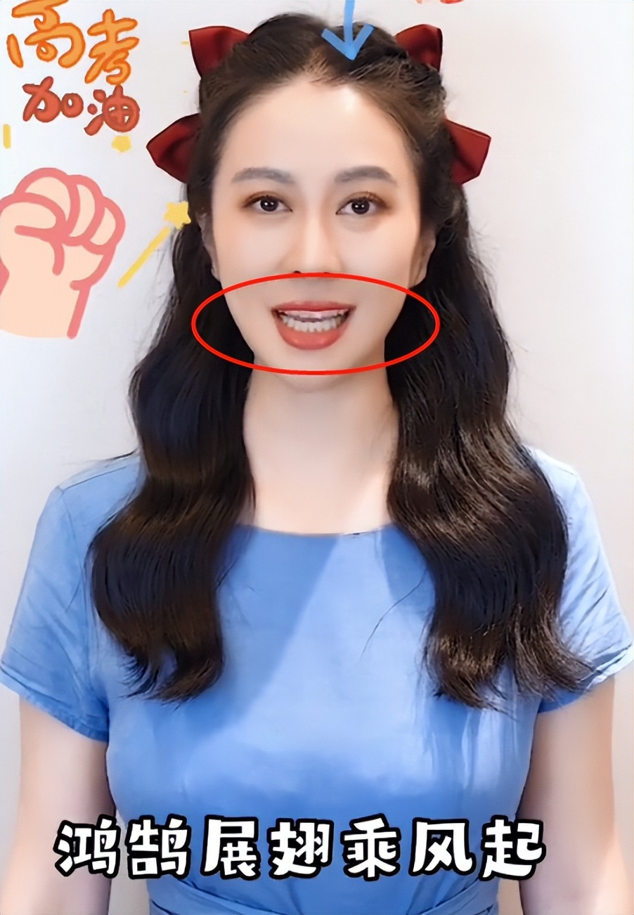 42岁叶璇近照曝光，模样大变嘴歪锥子脸，还撞脸多位女星