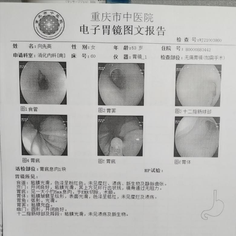 脾胃虚寒，脾失健运，水湿聚而成痰！看中医如何治疗胃息肉