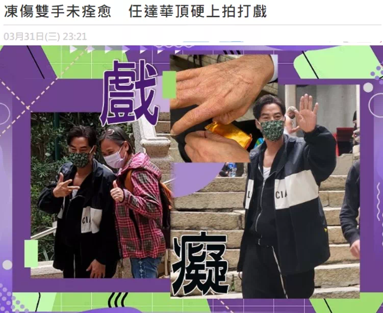 影帝影后多敬业？有人生吞12枚鸡蛋、鼻子被打歪，有人为戏锯门牙