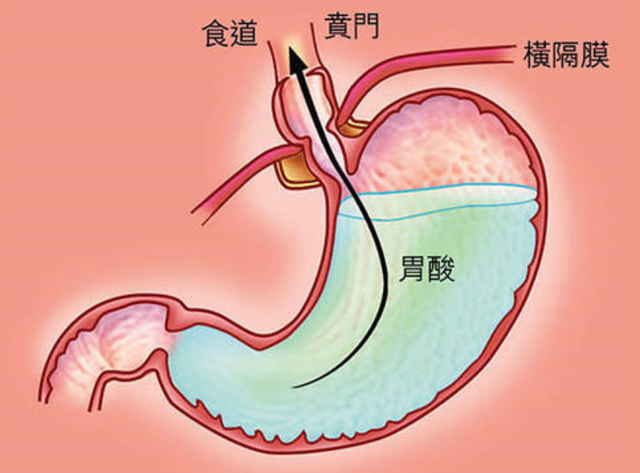 春季哪些水果吃多了会烧心?春季这些水果建议反酸的人少吃或不吃