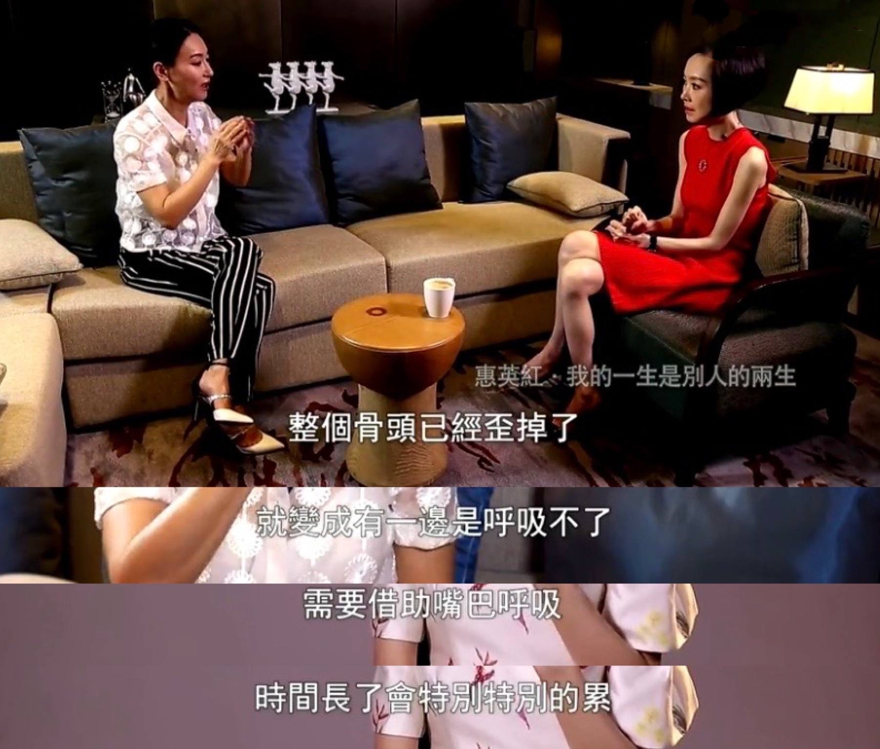 影帝影后多敬业？有人生吞12枚鸡蛋、鼻子被打歪，有人为戏锯门牙