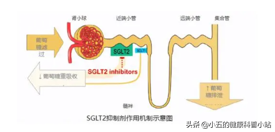 长期糖尿病引起血管损伤怎么办？合理使用4种药物，帮你保护血管