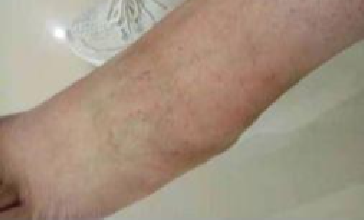 四川一“楼长”学姐查零食，13岁女生被罚150个下蹲，致终身残疾