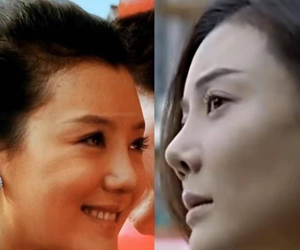 美人的脸却败在鼻子上?这9位女星鼻子好突兀,太可惜