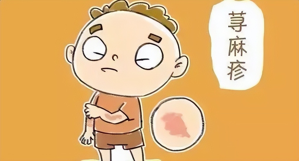 荨麻疹奇痒难忍?专家揪出6大"罪魁祸首",教你四招有效预防