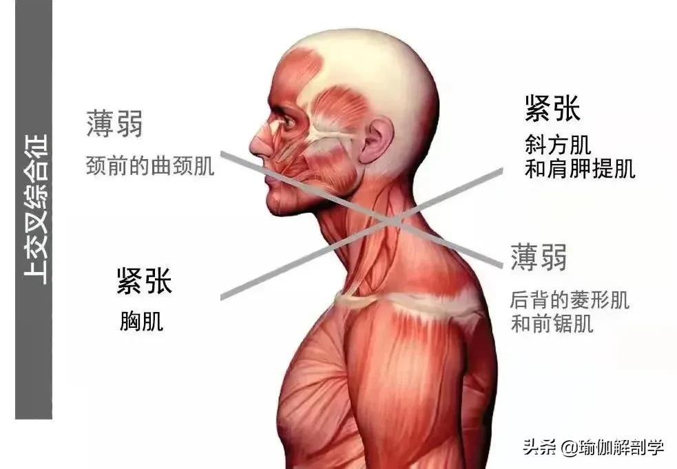 颈椎病锻炼(4个简单的动作每天在家练，改善乌龟脖，理疗颈椎病超级有效)